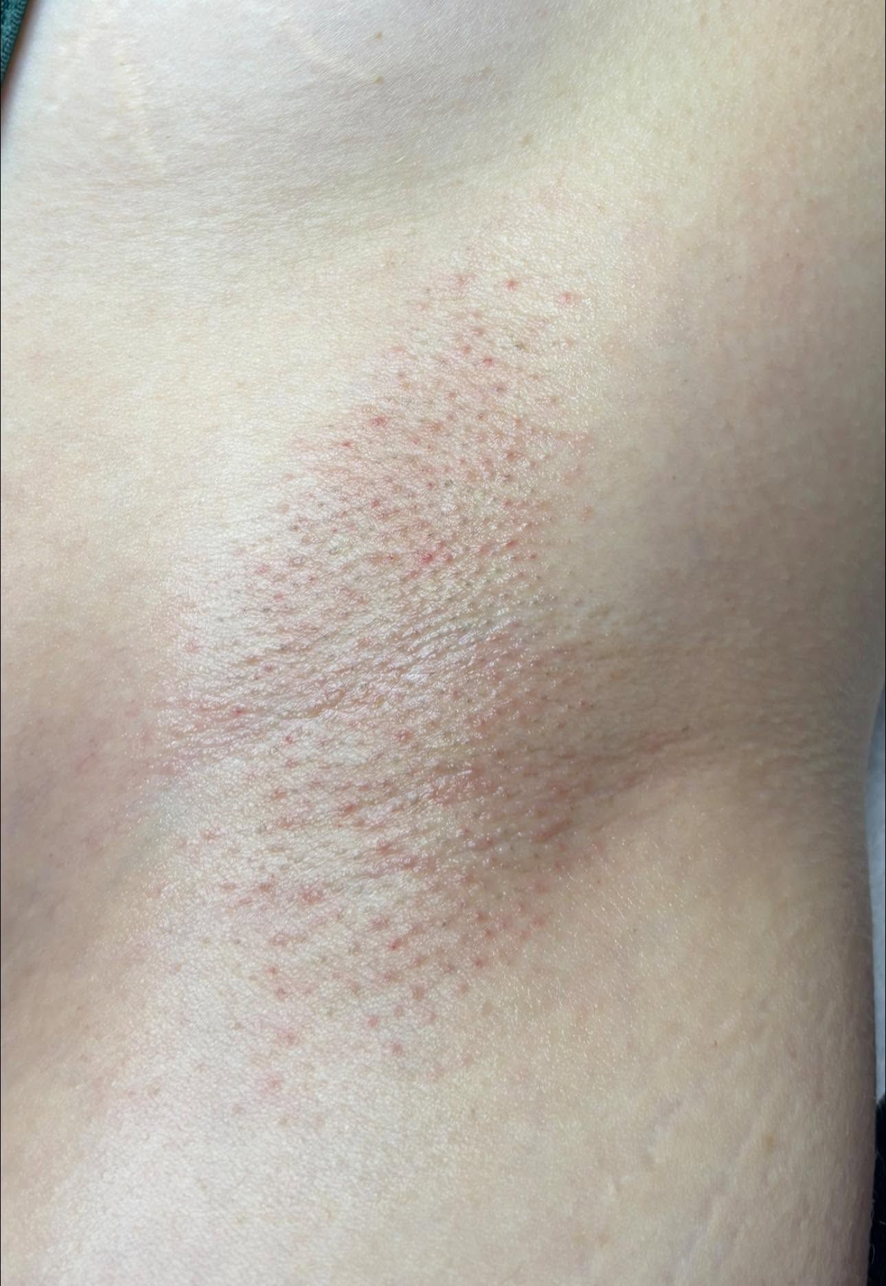 Before and after example - after