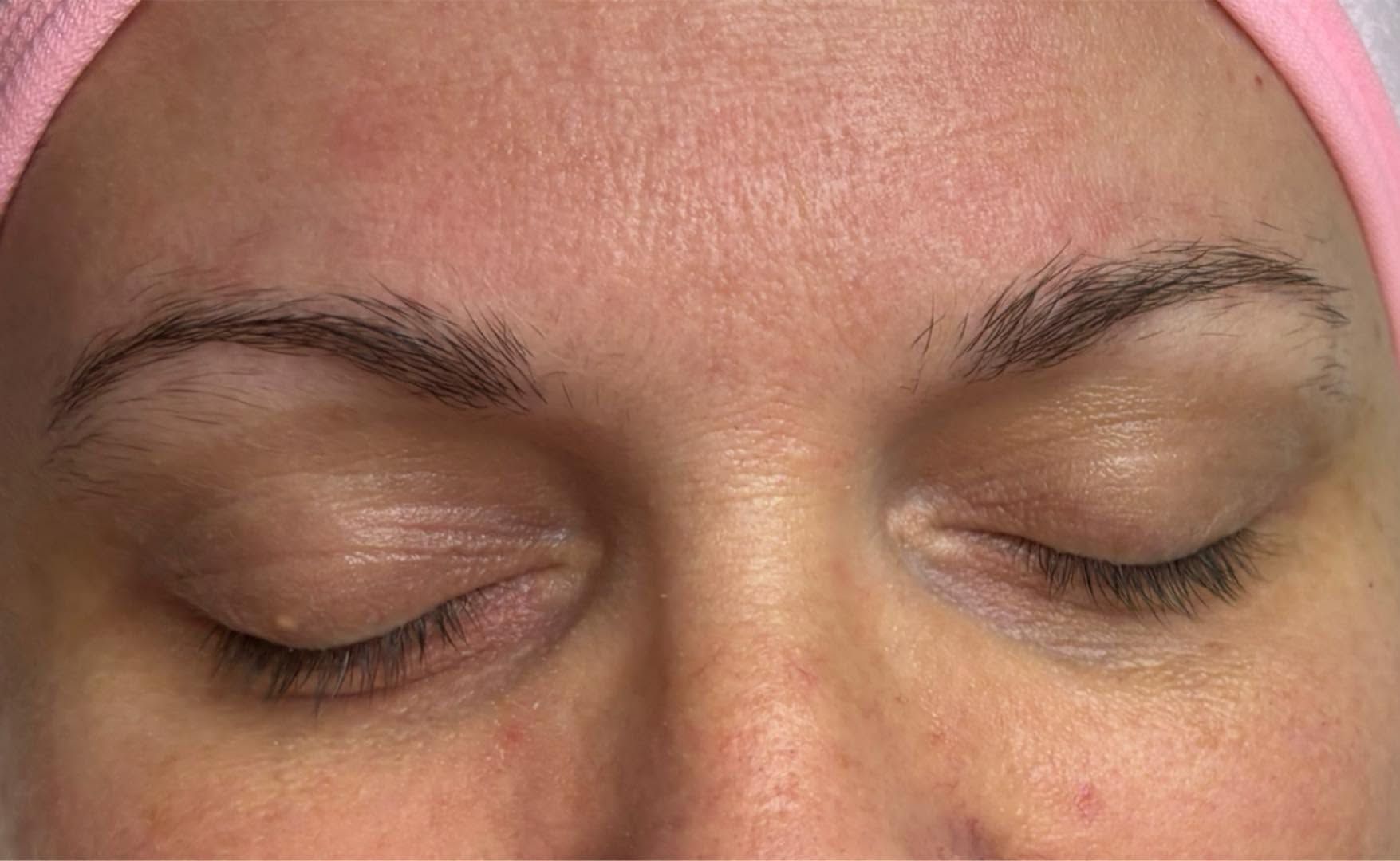 Before and after example - before
